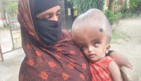 অস্বাভাবিক শিশু কন্যার ভার সইতে পারছেনা মা